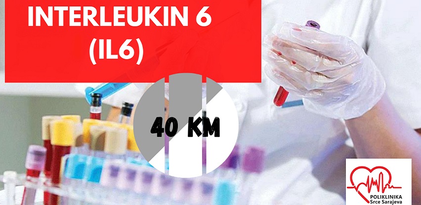 Poliklinika Srce Sarajeva laboratorijske usluge